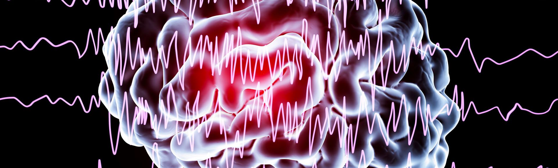 Neurofeedback